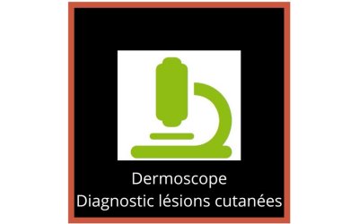 Dermatoscope - Diagnostic des lésions cutanées